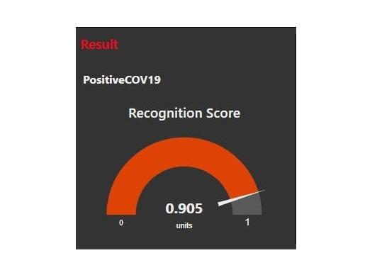 Interface AI-COVID_Röntgenaufnahmen_INNOVChallenge_white