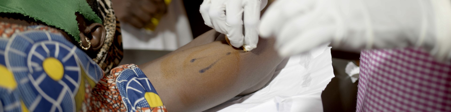 A midwife inserts a contraceptive implant into a woman’s arm.